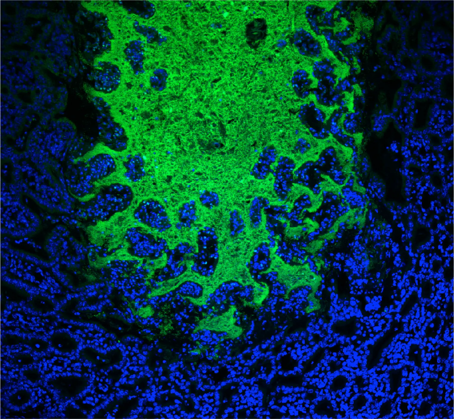 Microbiota intestinal bajo el microscopio electrónico