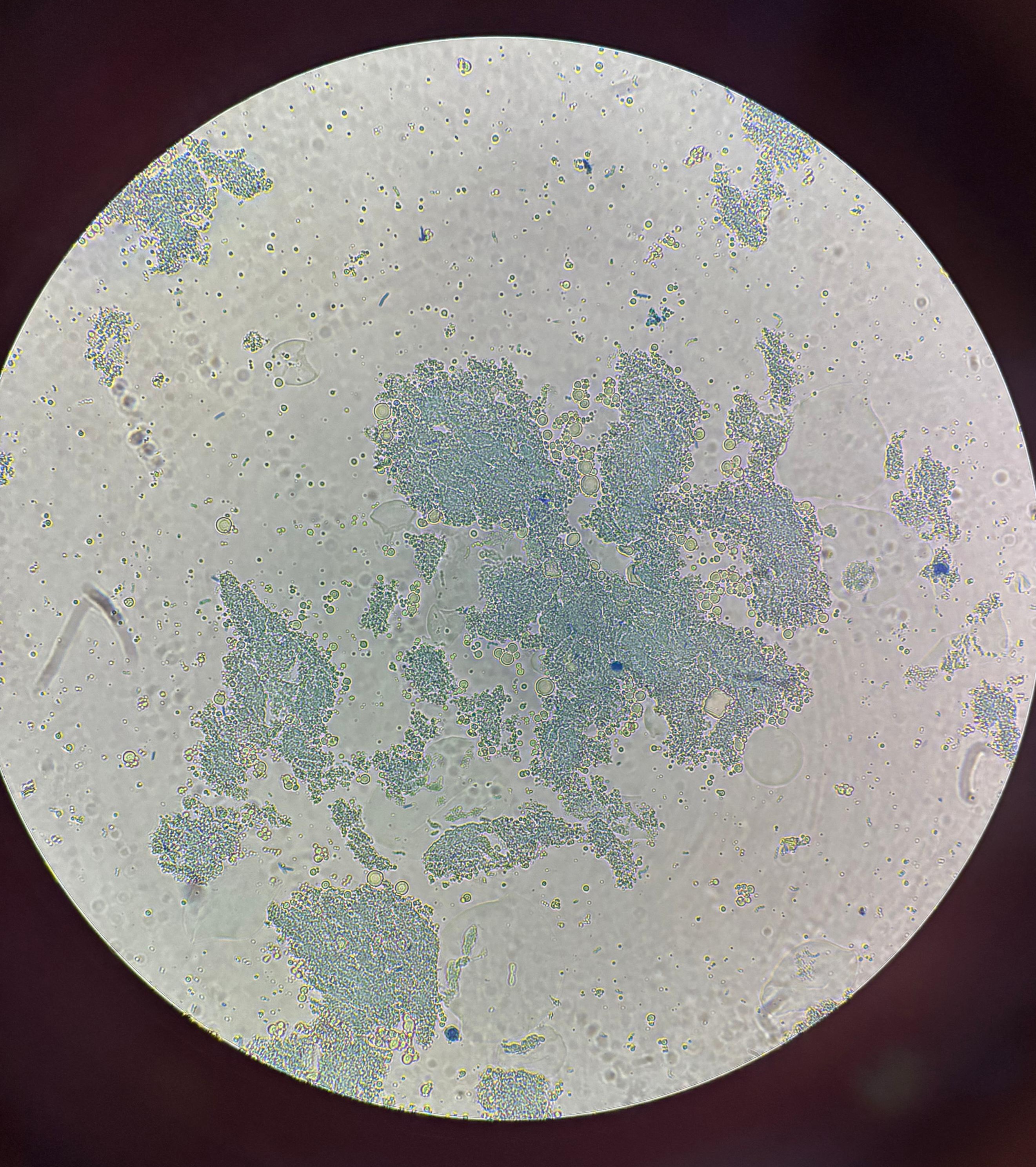 Bacterias lácticas al microscopio