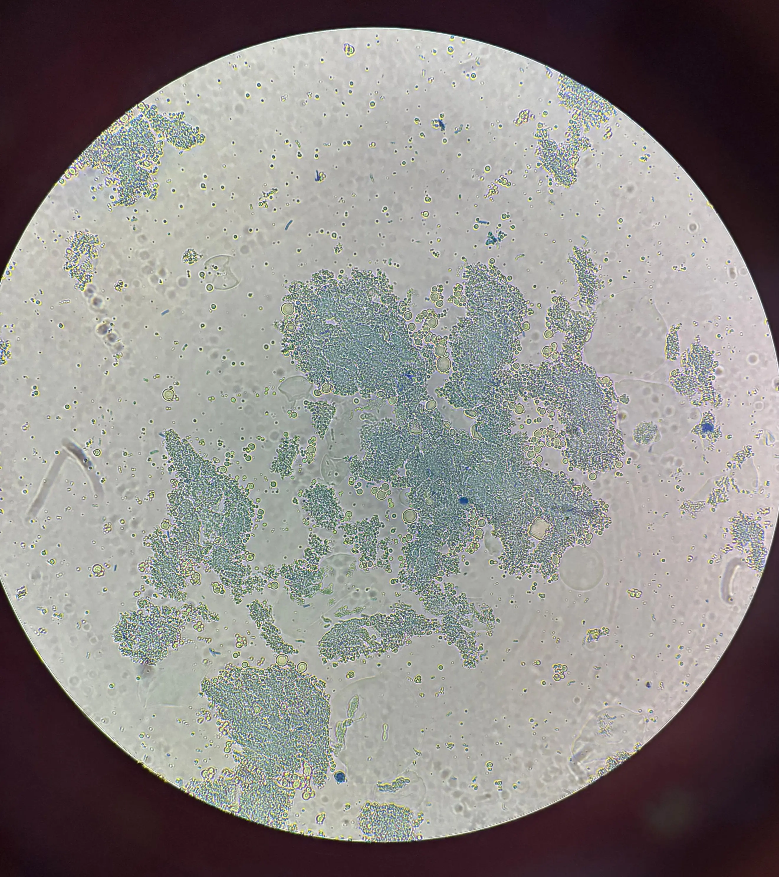 Siguiente artículo: La Guerra Silenciosa del Yogurt